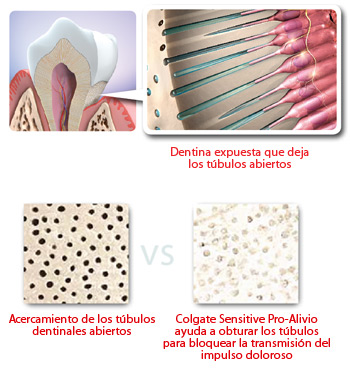 sensitive pro relief