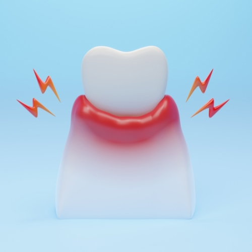 Diente con encías rojas e inflamadas, dolor por gingivitis o enfermedad periodontal