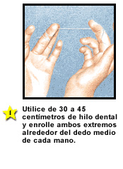 Hilado dental correcto